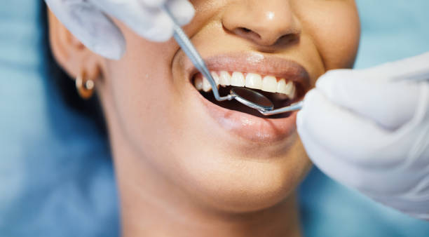 Best Urgent Care for Lost Fillings or Crowns in Richnd, MO